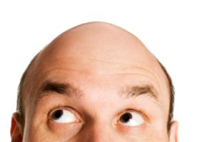 bigstock-bald-head-looking-up-isolated-18399977