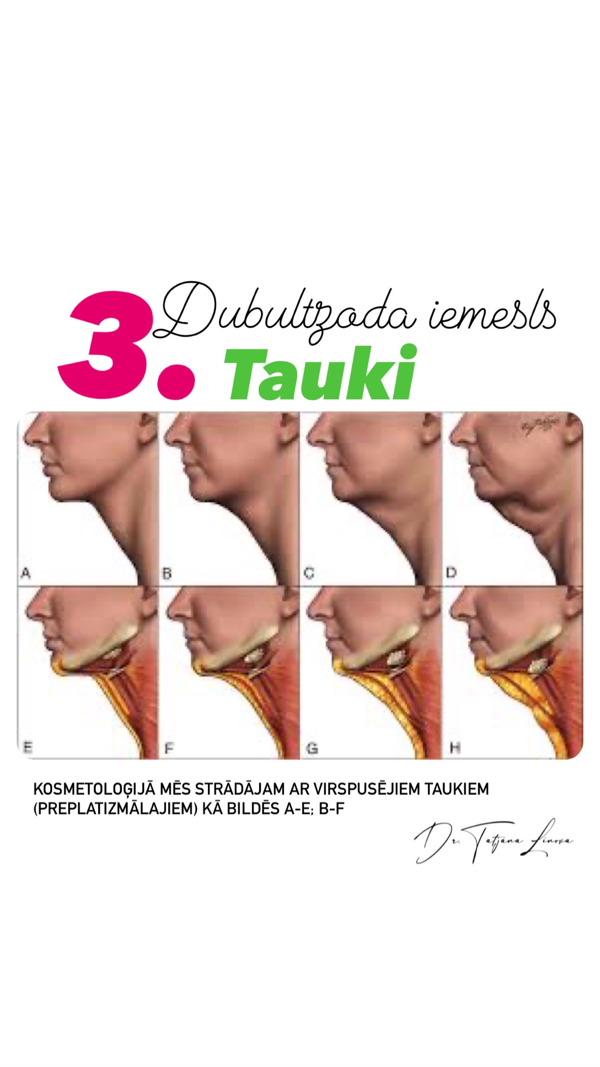 A collage of images of a person's neck  Description automatically generated
